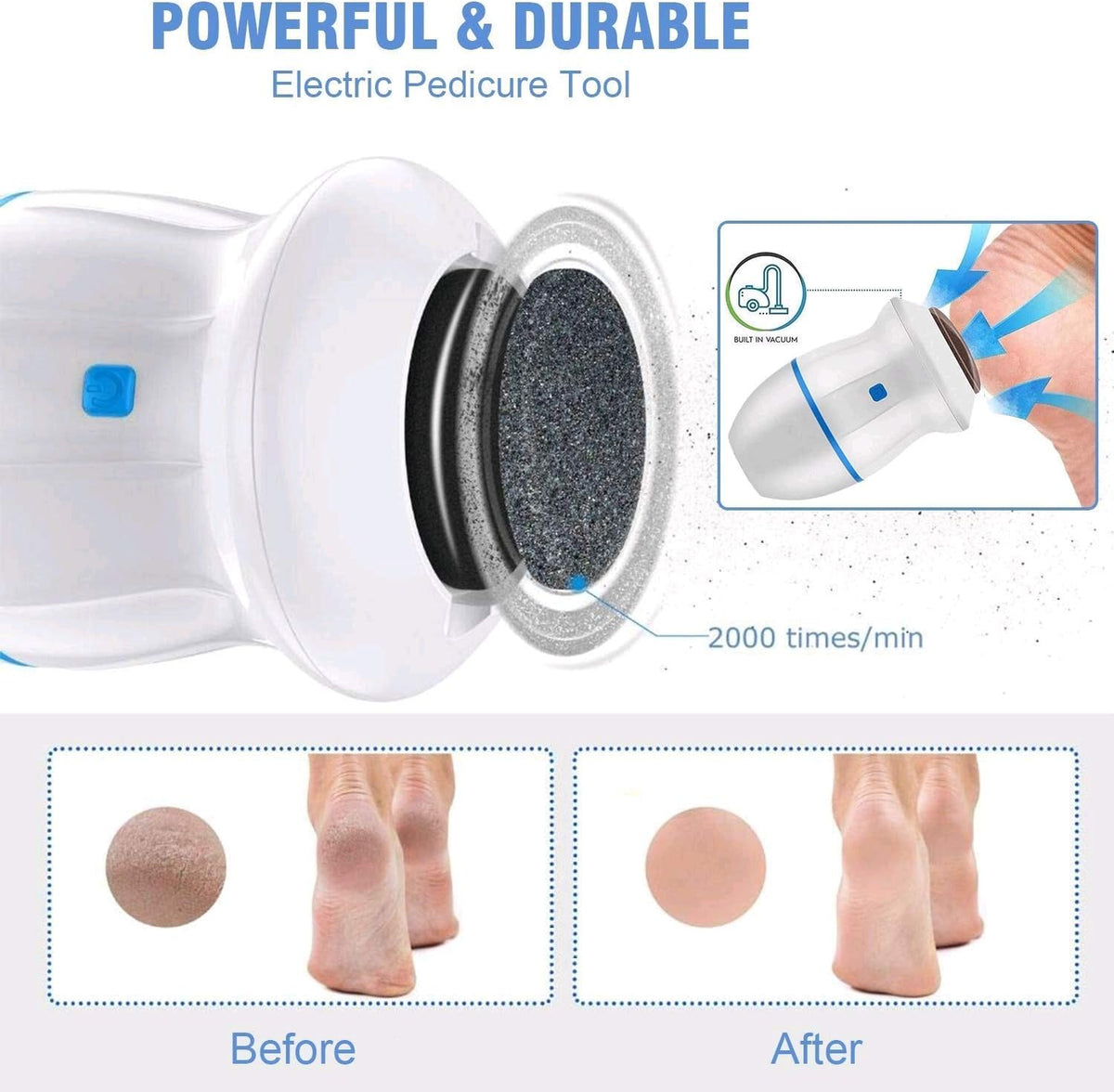 Electric Foot Grinder